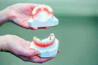 Dentures
