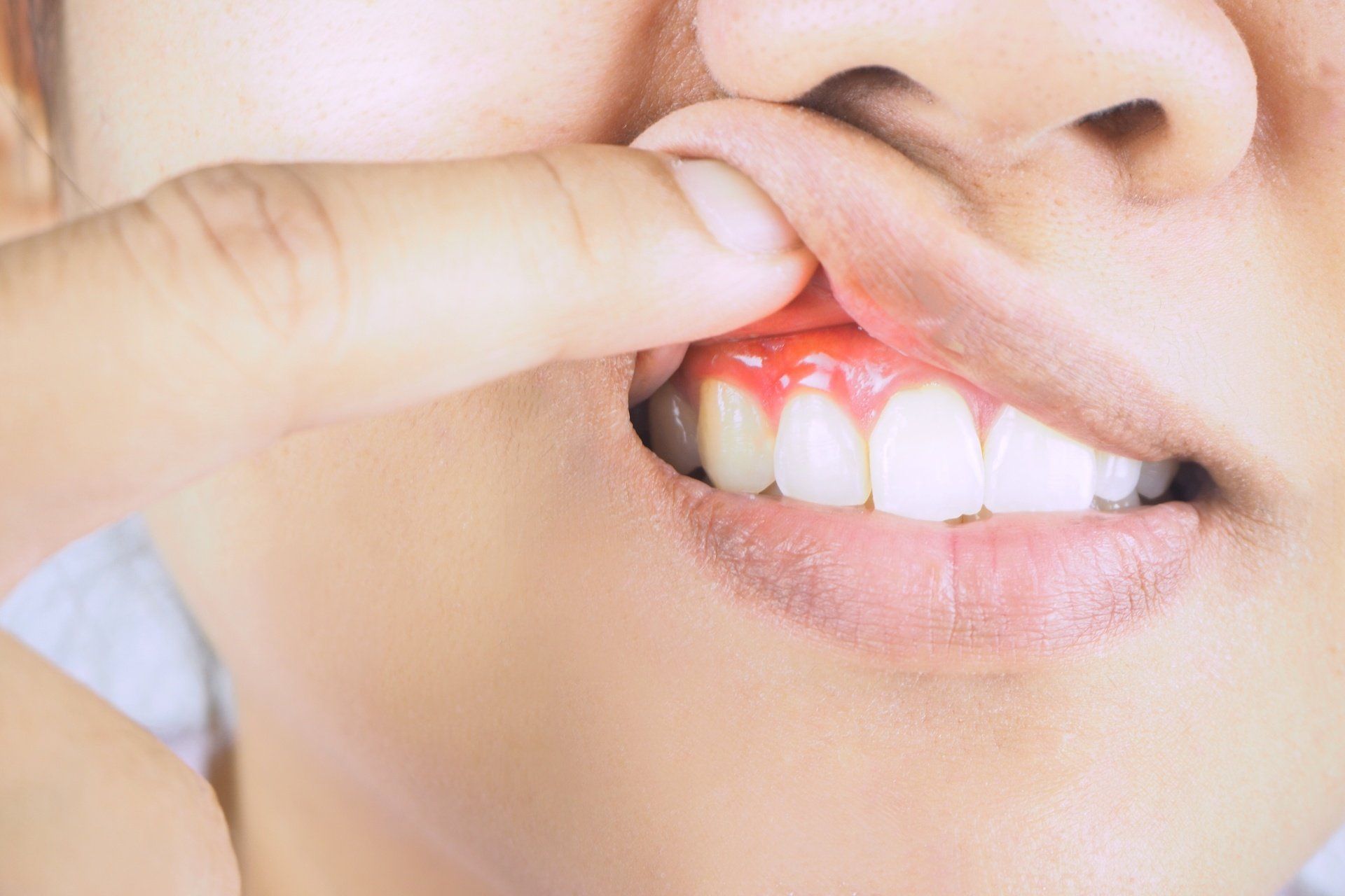 gum disease
