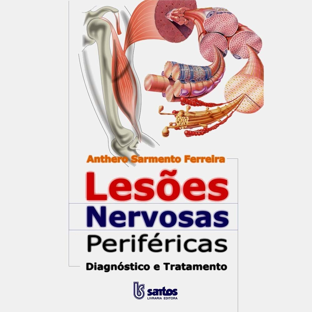 lesoes