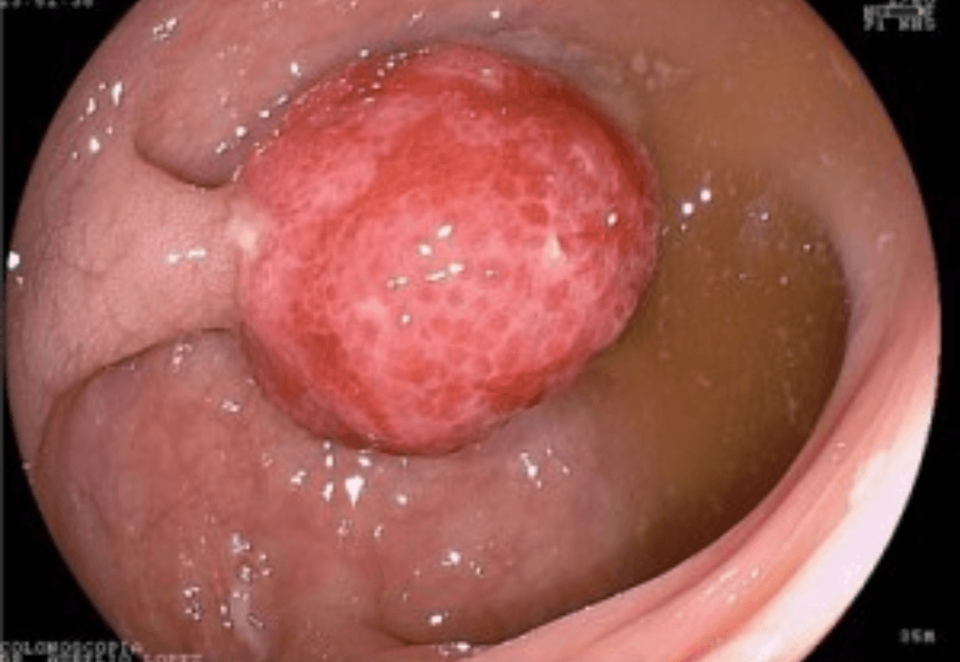 CLÍNICA DE CIRUGÍAS Y ENFERMEDADES GASTRO INTESTINALES