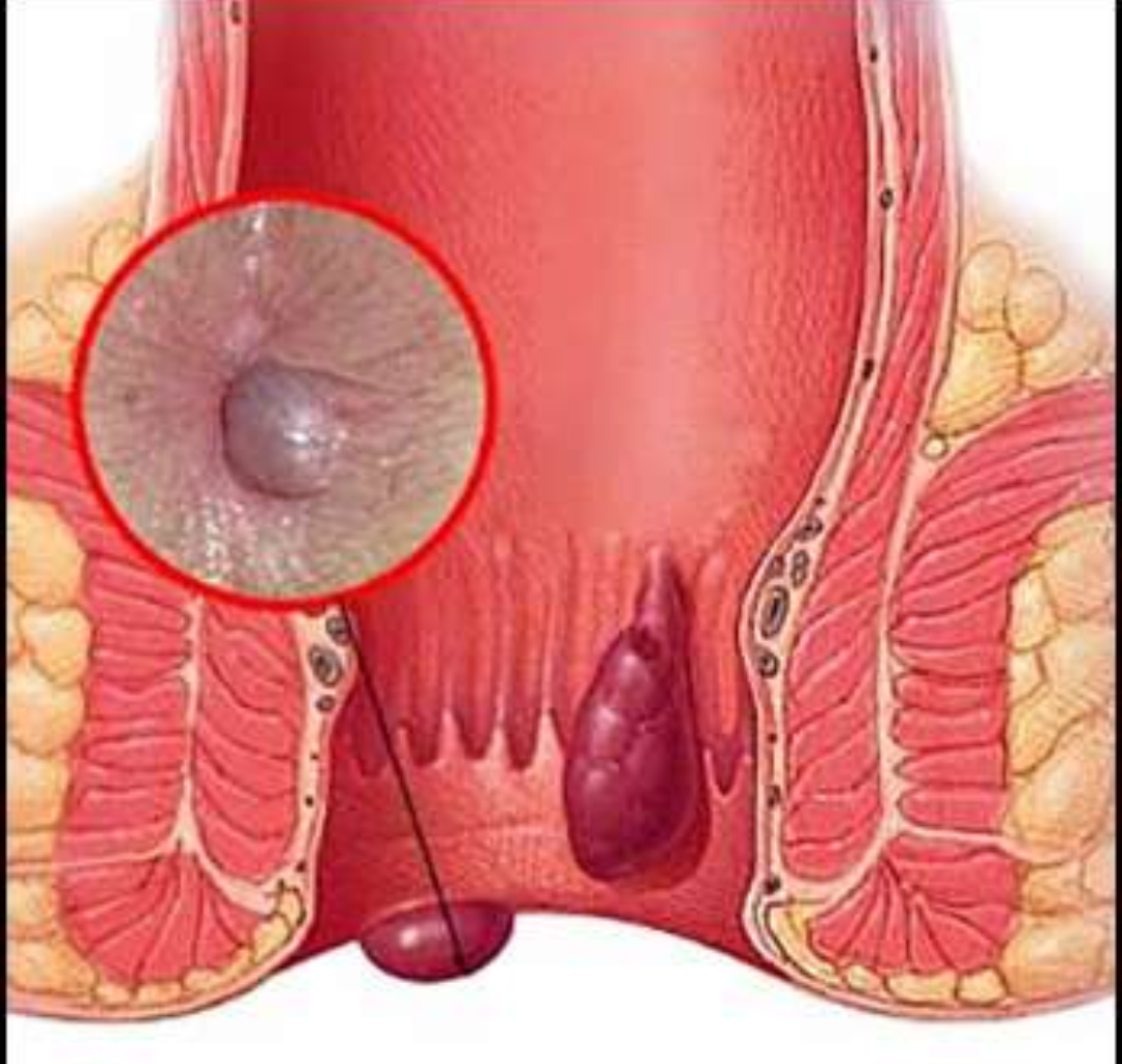 CLÍNICA DE CIRUGÍAS Y ENFERMEDADES GASTRO INTESTINALES
