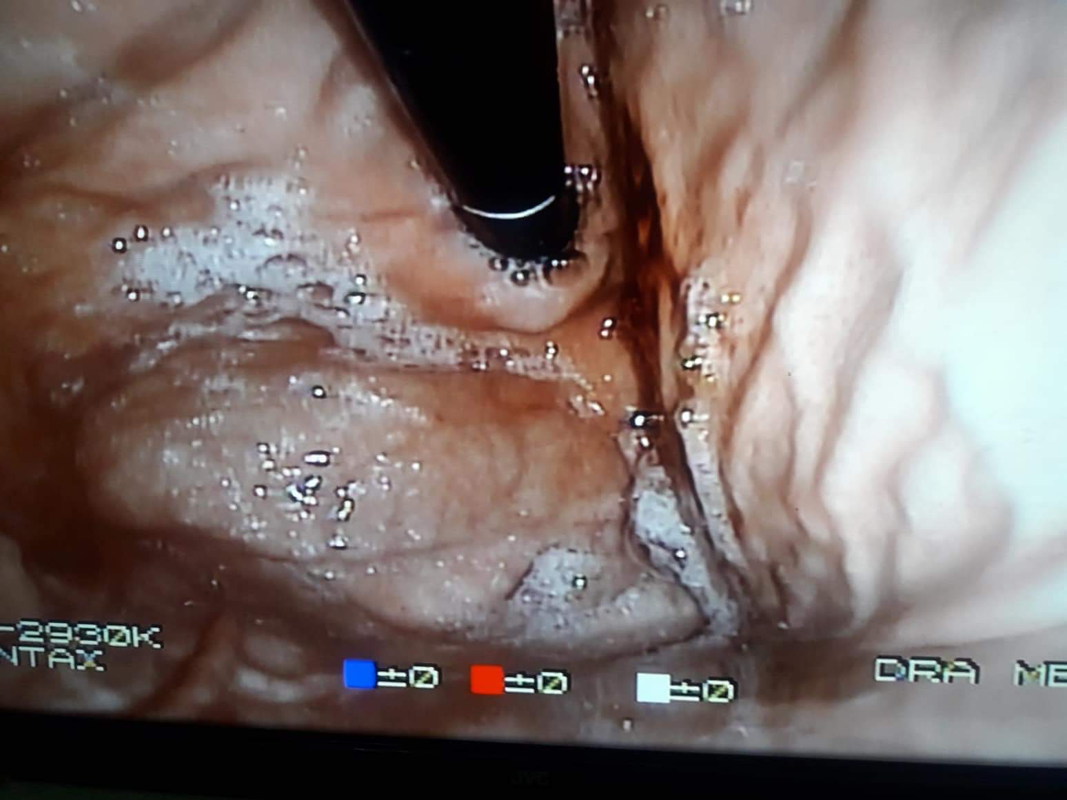 CLÍNICA DE CIRUGÍAS Y ENFERMEDADES GASTRO INTESTINALES