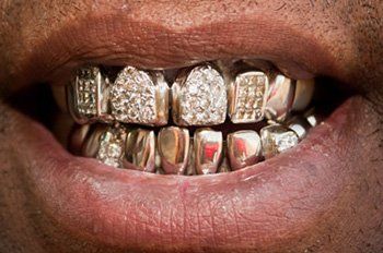 teeth crown