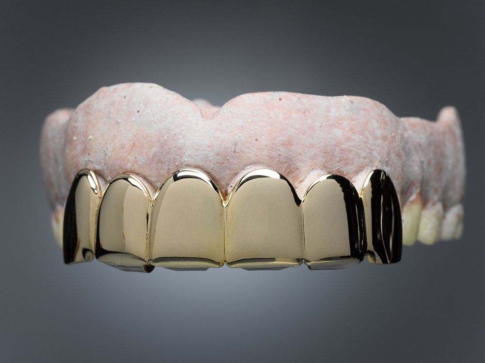 Gold Teeth