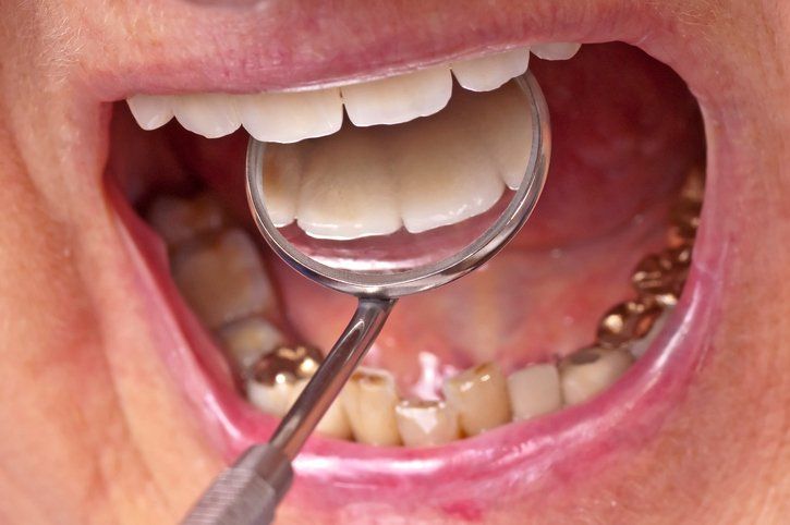 Gold Teeth Grill