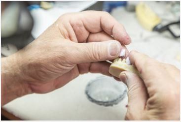 A dental technician works with a dental model, carefully placing a crown onto a tooth cast on a workbench.