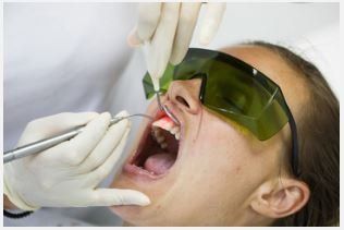 A dentist uses a laser tool on a patient wearing protective green goggles during a dental procedure.