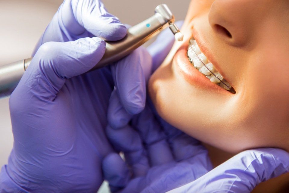 cure dentali