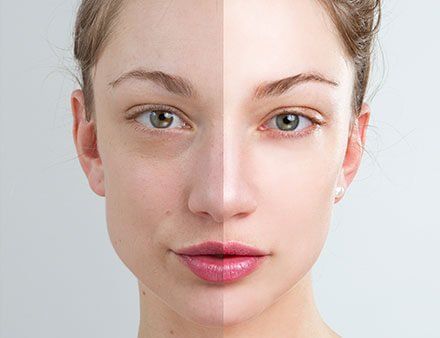 Retouching