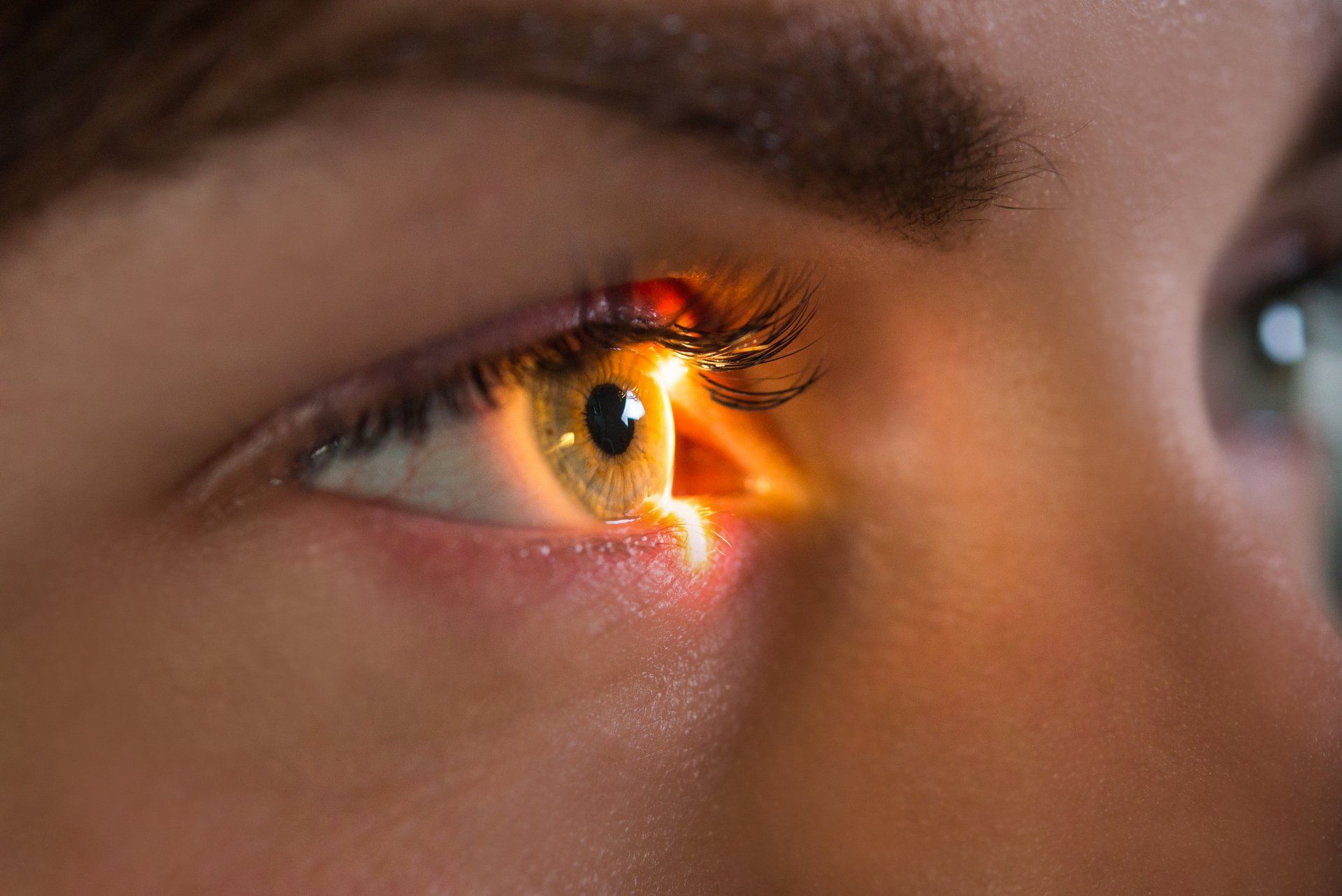 Retinal Conditions