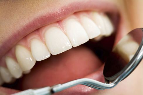 Healthy smile