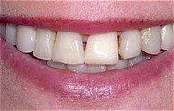 Smile 3