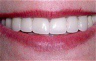 Smile 4