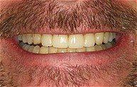 Smile 2