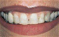 Smile 5