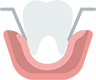Root Canals