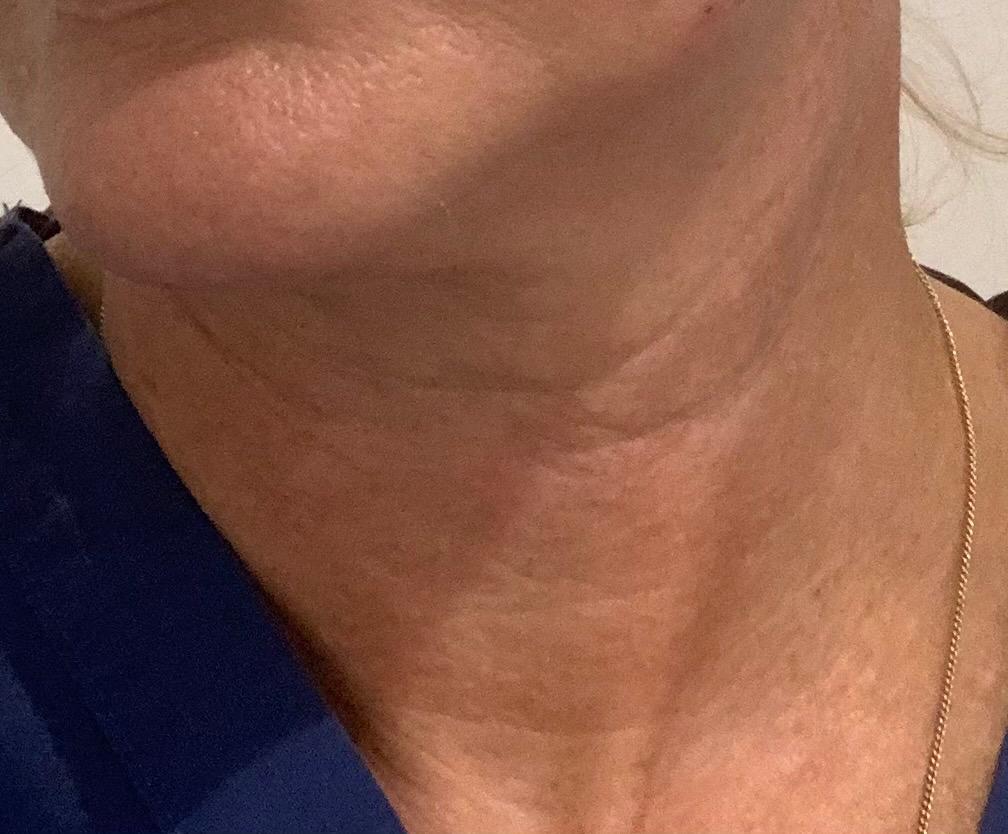 Zoom Neck