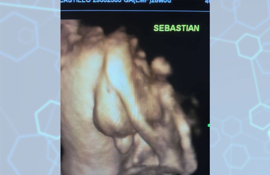 Centro médico Santa Anita-Perfil Biofísico
