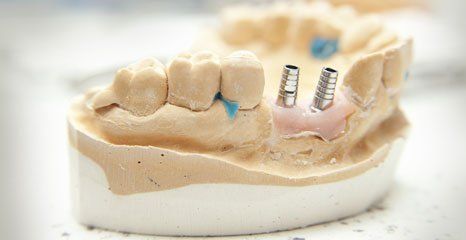 Dental repair