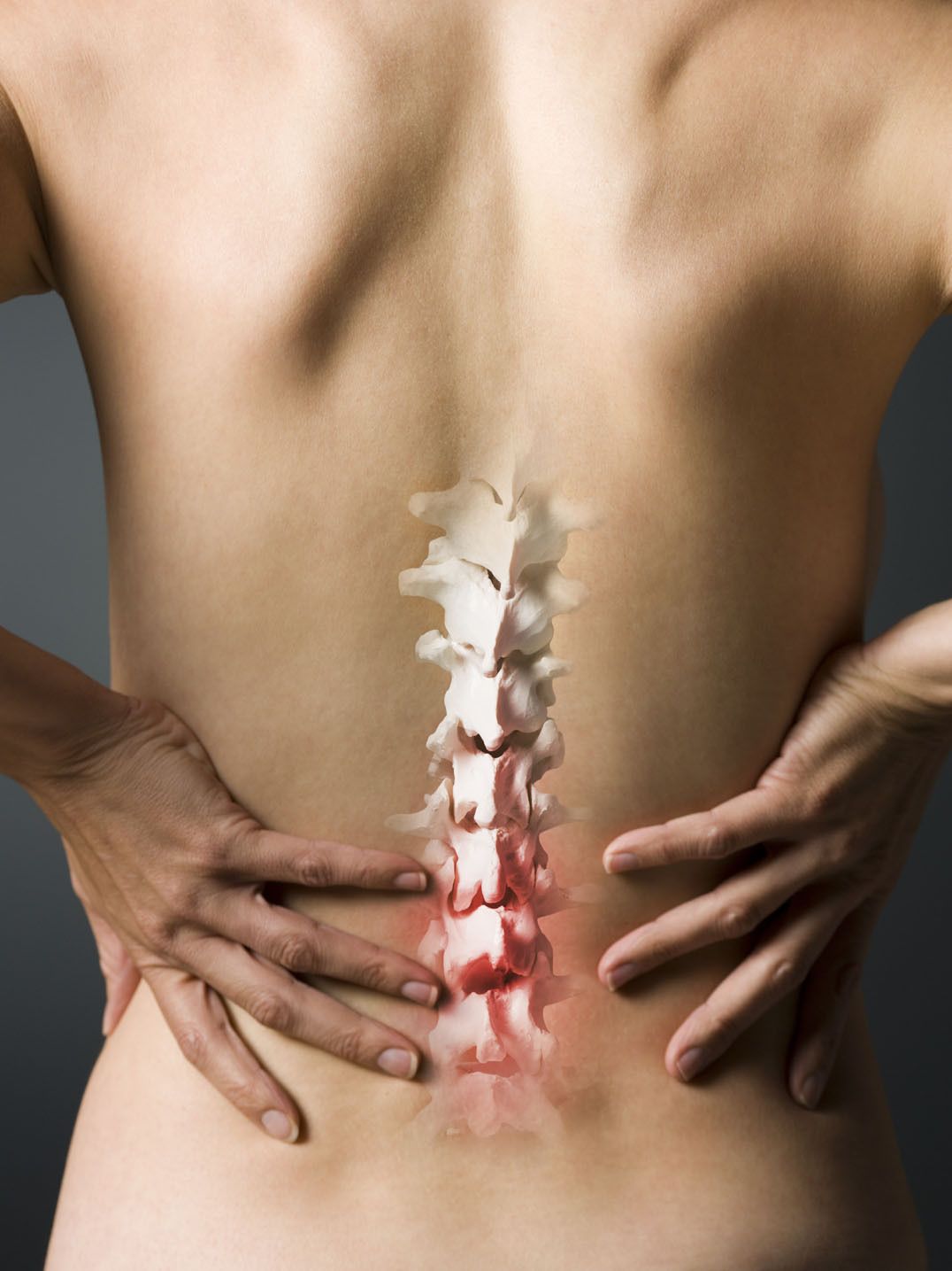 inter-vertebral disc