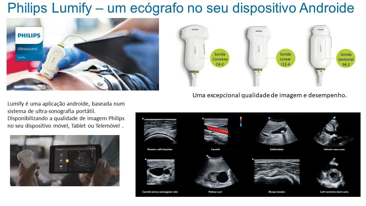 imagem Philips Lumify imagem Philips Lumify