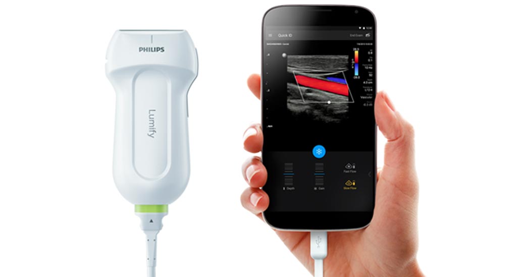 Ecografo Philips Lumify