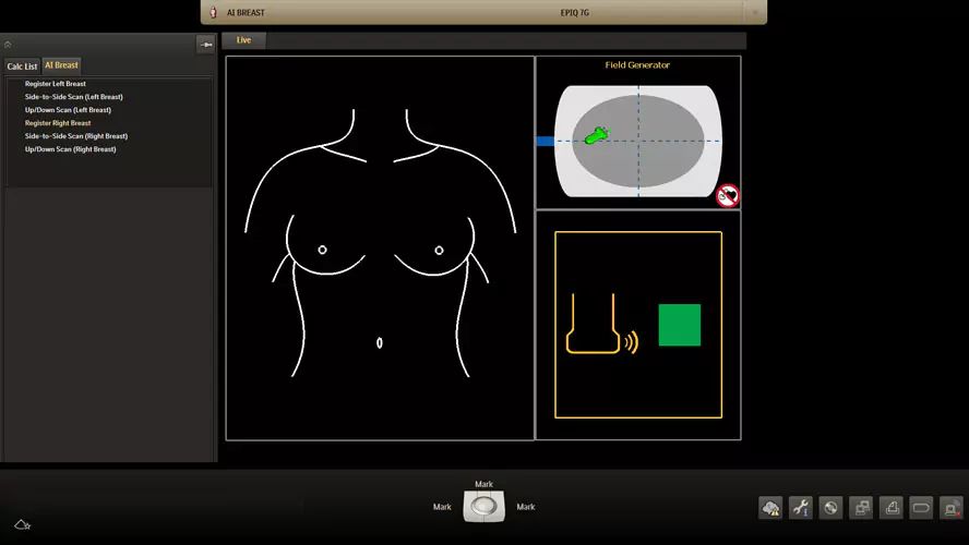 elastography