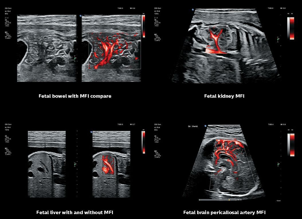Ecografia Vascular Ecografia Vascular
