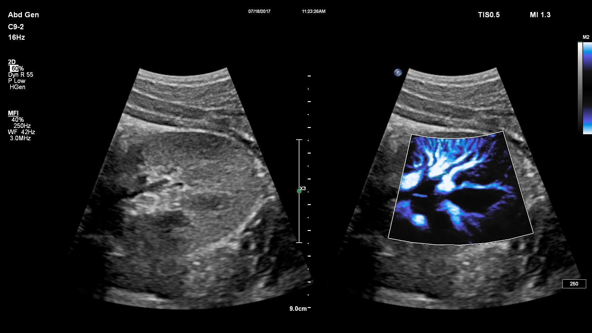 IMAGEM ECOGRAFICA