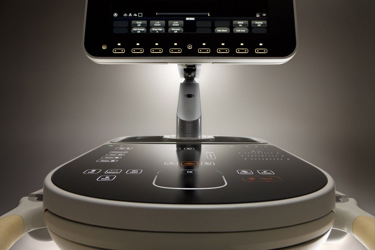 Ecografo Philips
