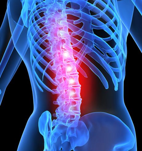 Chiropractor — Back Pain in New Bedford, MA