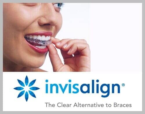 Woman smiling, inserting Invisalign aligner. Clear plastic aligner. Invisalign logo.