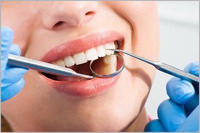 Examining mouth — Sealants in Glen Mills, PA