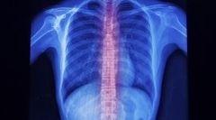trattamento vertigini, fisiokinesiterapia ortopedica, esercizi di deambulazione assistita