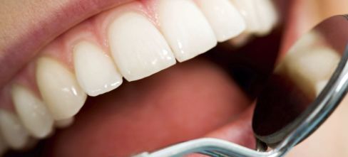 Healthy smile