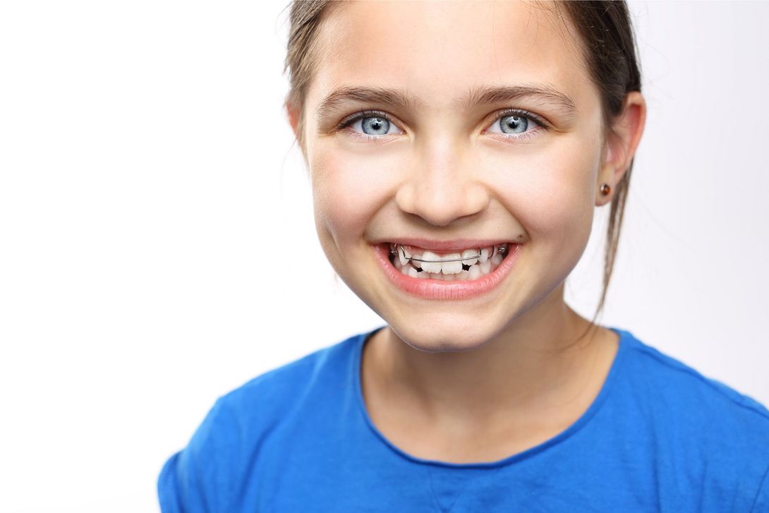 apparecchio dentistico visibile