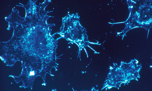 Cancer cells multiplying