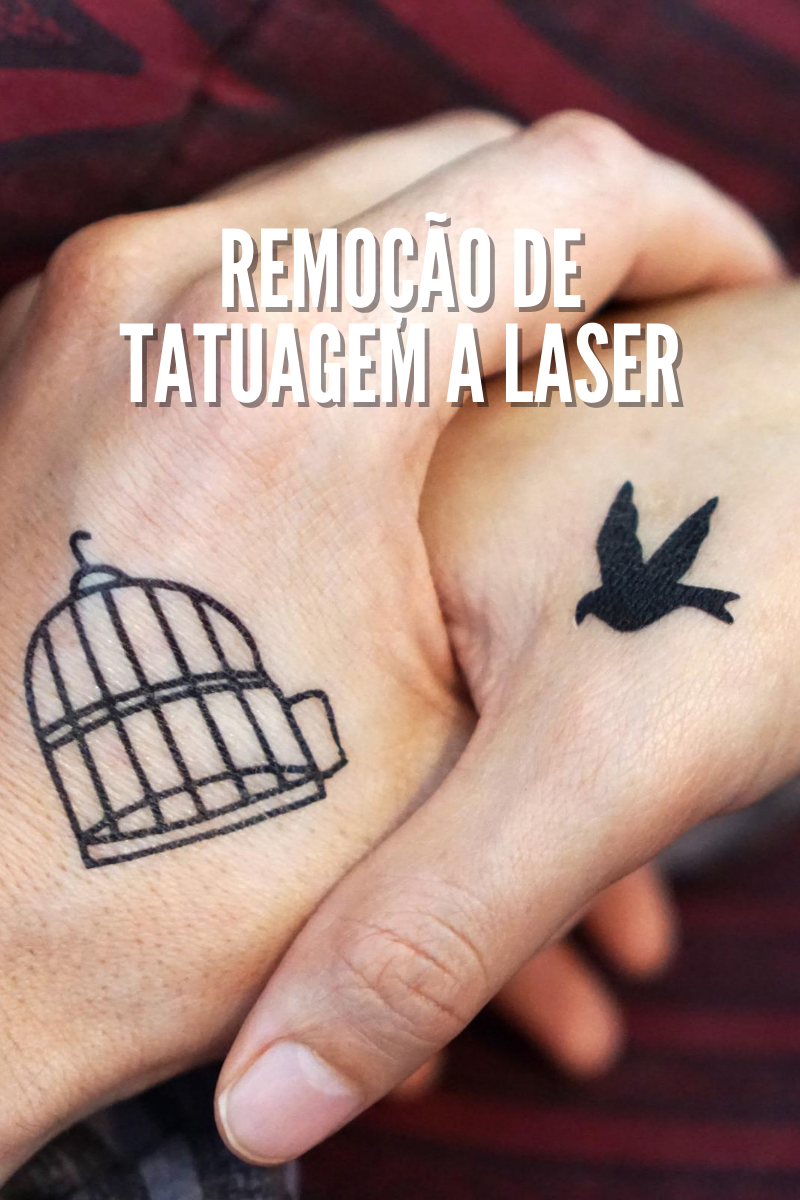 Perguntas Frequentes sobre Remoção de Tatuagens a Laser