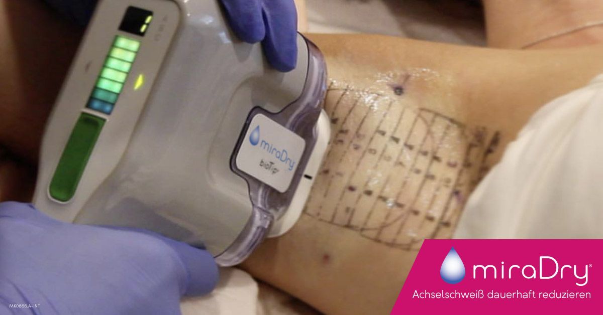 Eine Person erhält eine Miradry-Behandlung an den Achseln