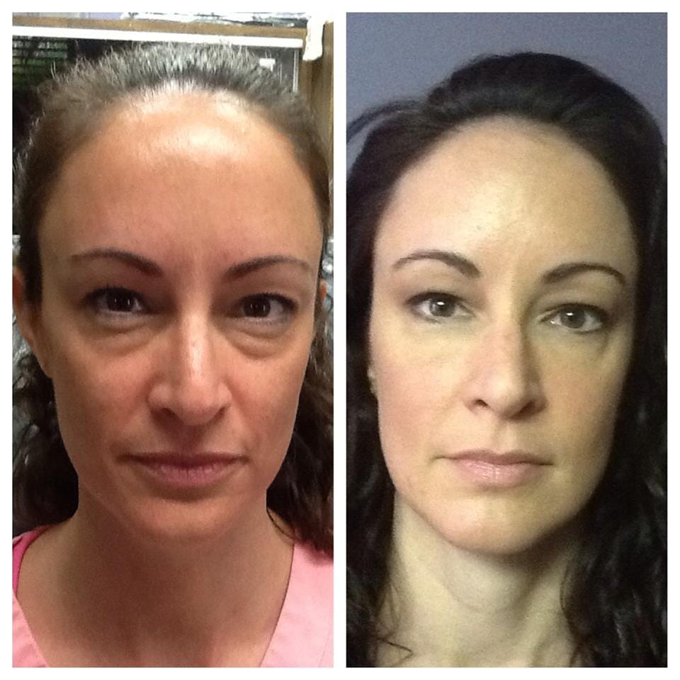 Cosmetic Dentistry — Whole Face Before and After in Merrillville, IN