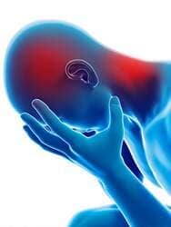 Headache Illustration - Chiropractor in Laguna Beach, CA Headache Illustration - Chiropractor in Laguna Beach, CA