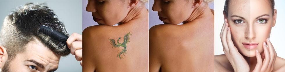 tricologia, rimozione tatuaggi, filler tricologia, rimozione tatuaggi, filler