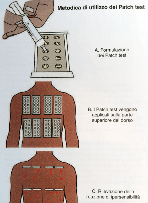 patch test 1