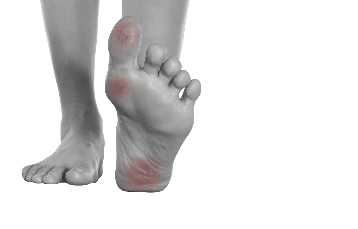 fungal bacteria site on patient's foot