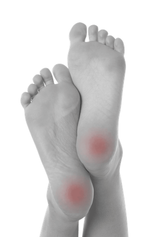 Patient ready for heel pain treatment Buffalo, NY