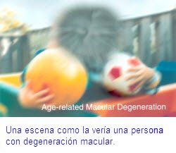una escena como la veria una persona con degeneracion macular