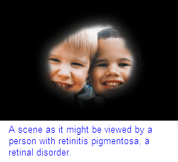 vision with Retinis pigmentosa