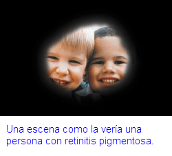 Una escena como la veria una persona con Retinis pigmentosa
