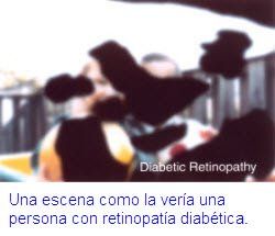 una escena como la veria una persona con retinopatia diabetica