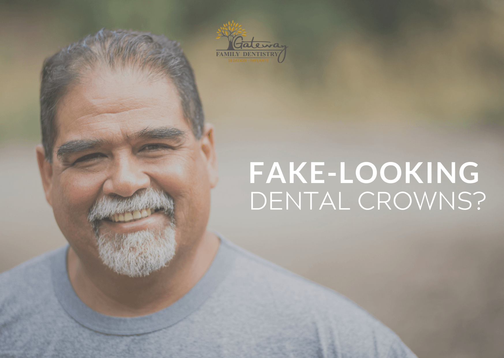 My Dental Crowns Look Fake My Dental Crowns Look Fake
